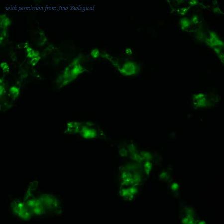 Sino Biological HG10084-ACG image 1