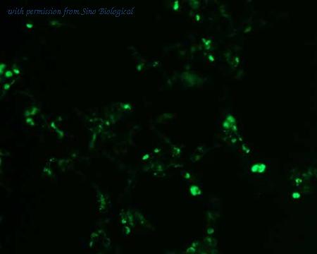 Sino Biological HG10141-ACG image 1