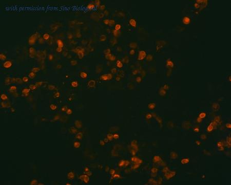 Sino Biological HG15877-NF image 1