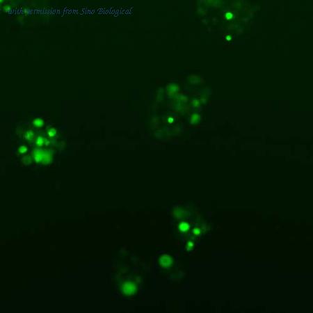 Sino Biological HG10215-ACG image 1