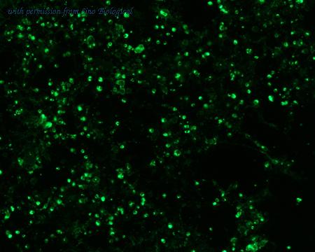 Sino Biological HG12302-ACG image 1