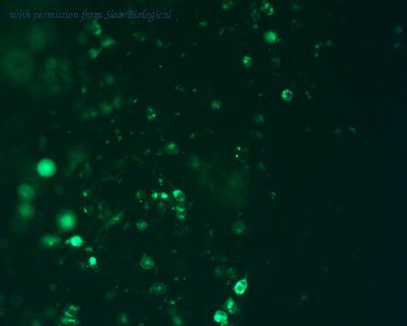 Sino Biological VG40304-CF image 1