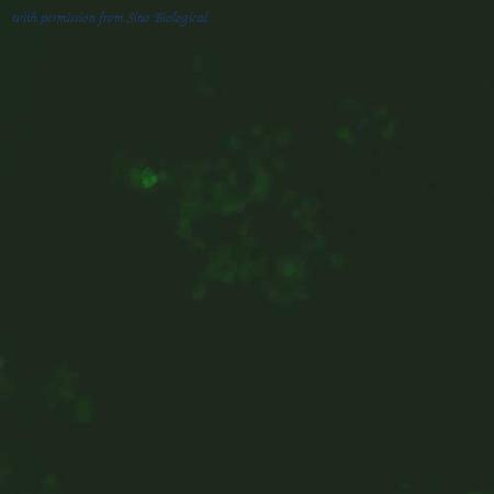 Sino Biological HG10456-ACG image 1