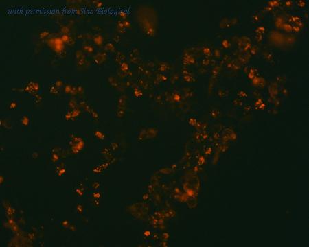 Sino Biological HG11074-NF image 1