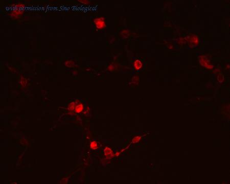 Sino Biological HG10084-ACR image 1