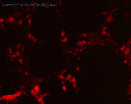 Sino Biological HG11263-ACR image 1