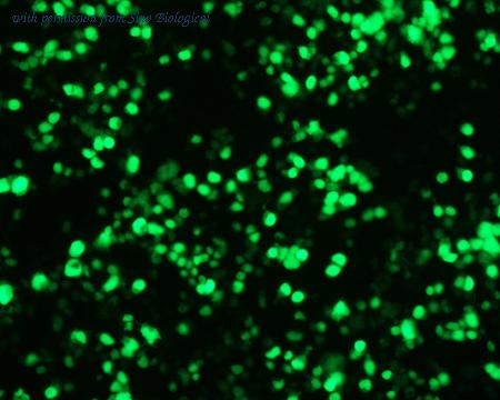 Sino Biological HG10014-ANG image 1