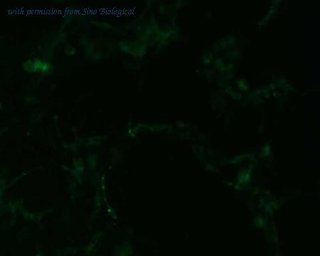 Sino Biological HG11880-ACG image 1