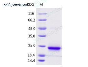 Sino Biological 12259-H07E6 image 1