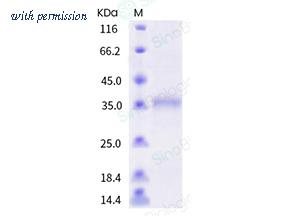 Sino Biological 40592-V08H73 image 1