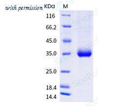 Sino Biological 40592-V08H68 image 1