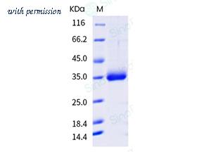 Sino Biological 40592-V08H75 image 1