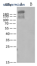 Sino Biological 40592-R493 image 1