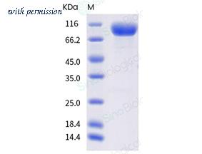 Sino Biological 10109-H41H-B image 1