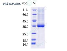 Sino Biological 40592-V08H101 image 1