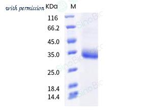 Sino Biological 40592-V08H92 image 1