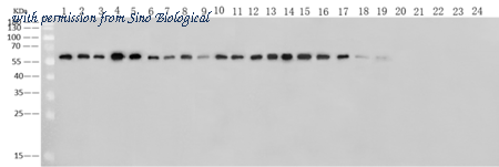 Sino Biological 40208-MM04 image 1