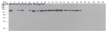 Sino Biological 40208-R113 image 1