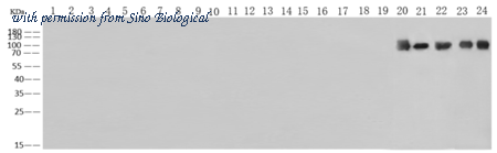 Sino Biological 40438-MM09 image 1