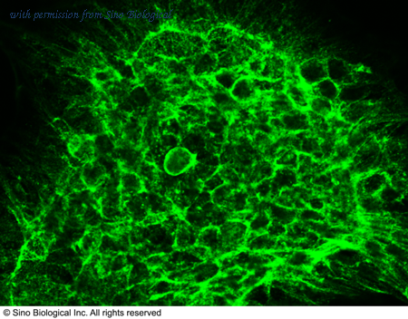 Sino Biological 100449-T46 image 1