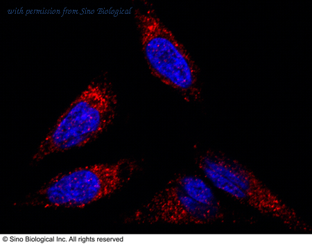Sino Biological 100612-T34 image 1