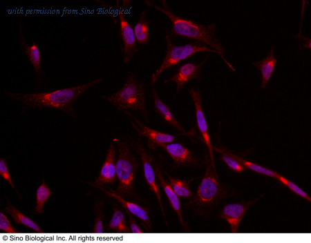 Sino Biological 100733-T42 image 1