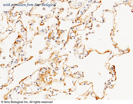 Sino Biological 10101-RP02 image 1