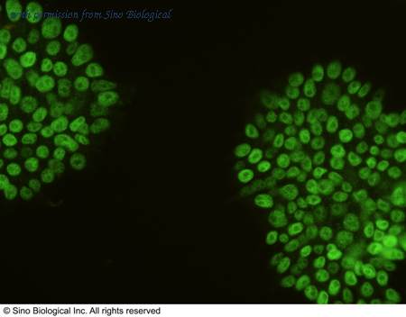 Sino Biological 101286-T34 image 1