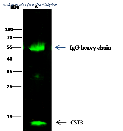 Sino Biological 10439-RP02 image 1