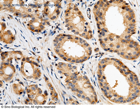 Sino Biological 10617-RP02 image 1