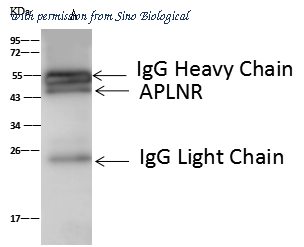 Sino Biological 106982-T04 image 1