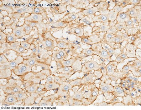 Sino Biological 10817-RP02 image 1