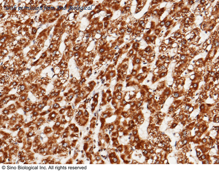 Sino Biological 10990-RP02 image 1
