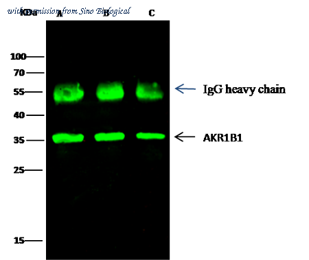 Sino Biological 11294-RP02 image 1