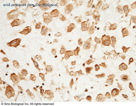 Sino Biological 12656-RP02 image 1