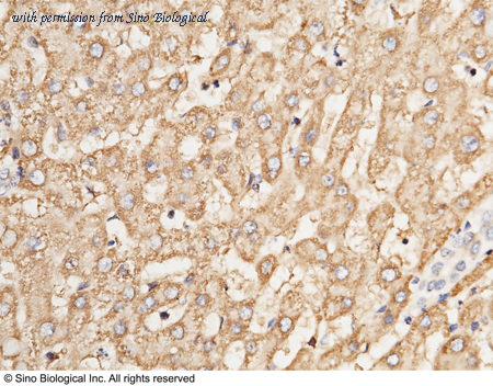 Sino Biological 13146-RP02 image 1
