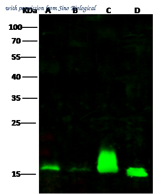 Sino Biological 14321-T52 image 1