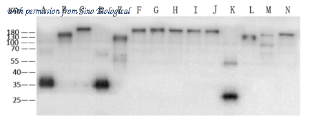Sino Biological 40592-MM117 image 1