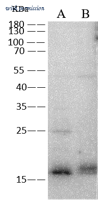 Sino Biological 12093-T62 image 1