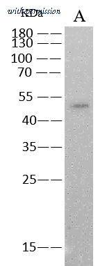 Sino Biological 68097-MM186 image 1
