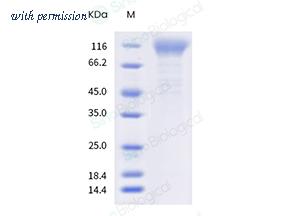 Sino Biological 11202-H41H-B image 1