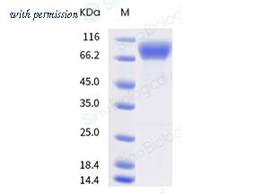 Sino Biological 10161-H49H-B image 1