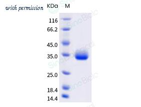 Sino Biological 40592-V08H113 image 1