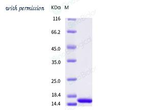 Sino Biological 80045-RNAE image 1