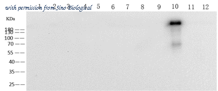 Sino Biological 68085-MM10 image 1