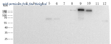 Sino Biological 68086-MM06 image 1