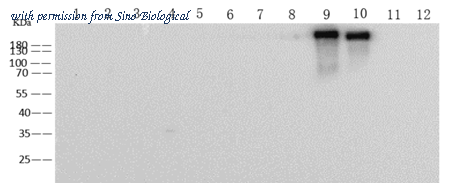 Sino Biological 68086-MM23 image 1