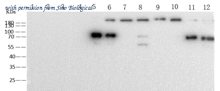 Sino Biological 68086-MM38 image 1