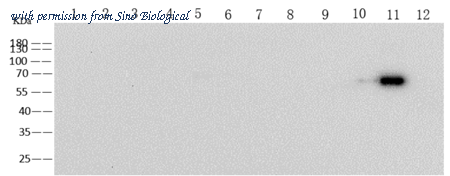 Sino Biological 68088-MM05 image 1