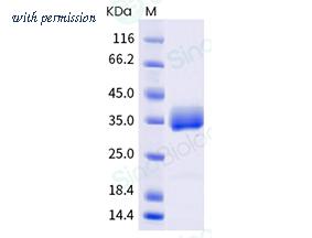 Sino Biological 40592-V08H128 image 1